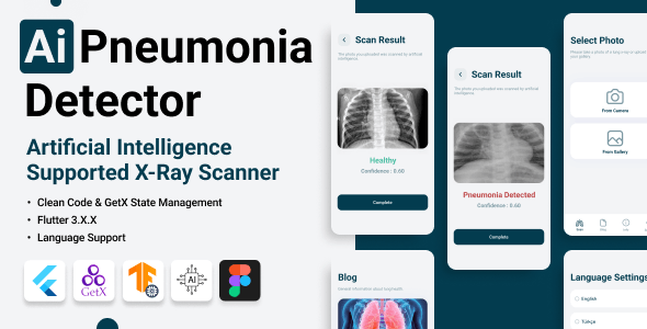 Flutter TensorFlow Artificial Intelligence Detection of Lungs Pneumonia ...